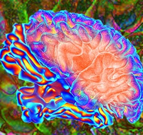 Colorful image of the human brain