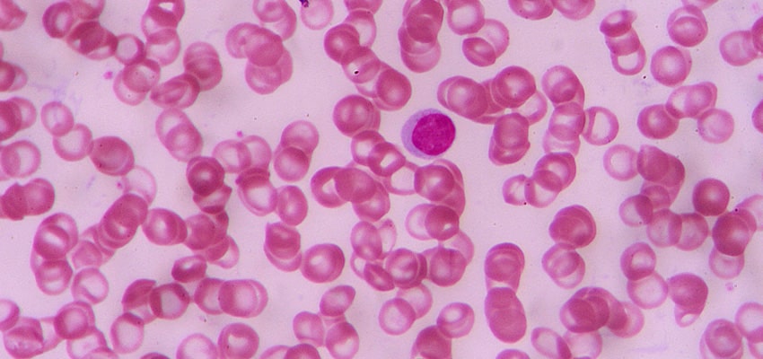 pink-stained cells
