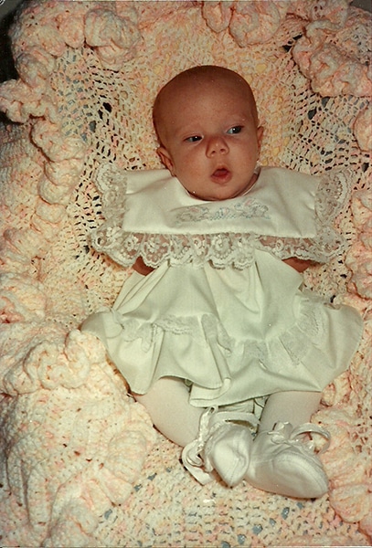 Alexis on Easter 1991, shortly after returning home from her first surgery to remove her occipital encephalocele. (Photo courtesy of Shelly family)