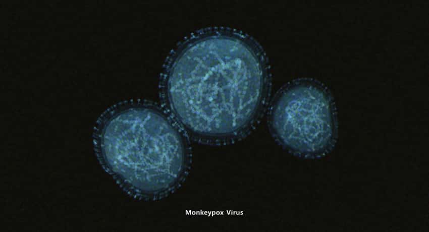 a microscopic image of the monkeypox virus