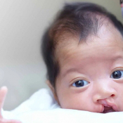 Texas Cleft-Craniofacial Care Header SEO