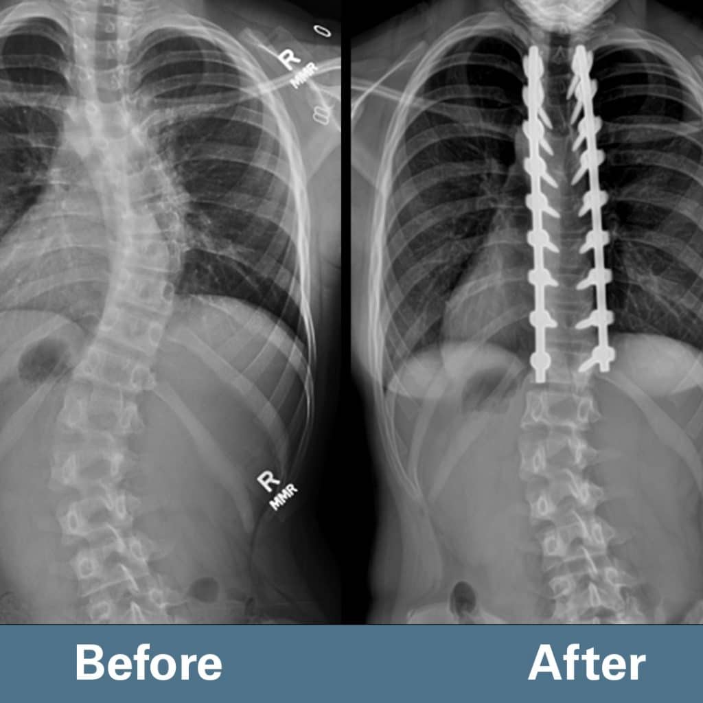 Ellison McDonald spine comparison