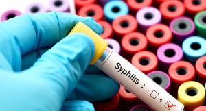 The Houston Health Department issued a syphilis outbreak in July 2023 regarding the 128% increase in Houston. Statistics show a nine-fold rise locally just in congenital syphilis, or babies born with it.