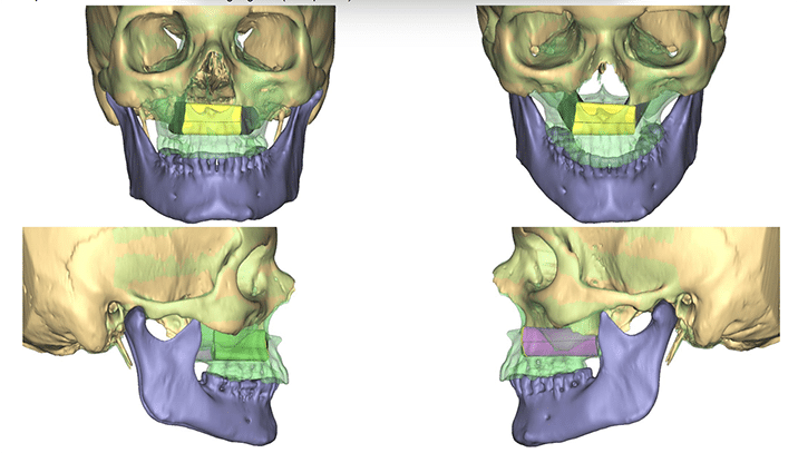 3d images of human skull