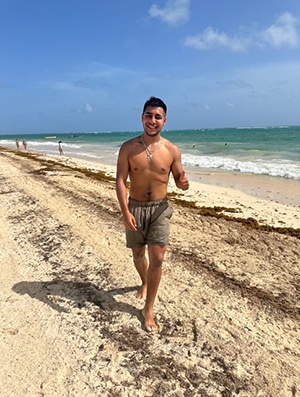 Fenando Carlos as an adult enjoying a day on the beach after suffering from a CDF recurrence