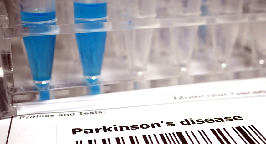 Parkinson's disease lab test close-up