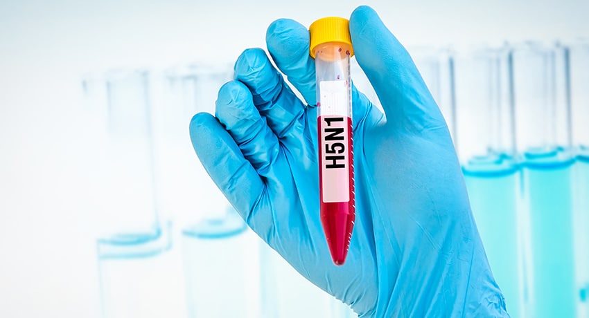 H5N1 test tube