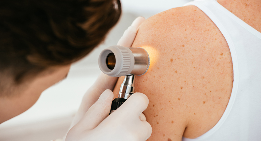 Dermatologist in latex gloves holding dermatoscope while examining patient with skin disease