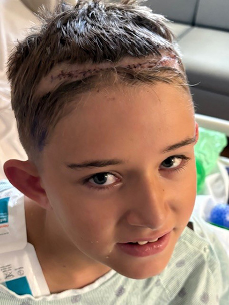 Carter after electrode placement surgery