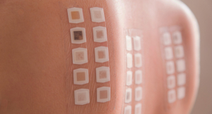 Allergy patch test