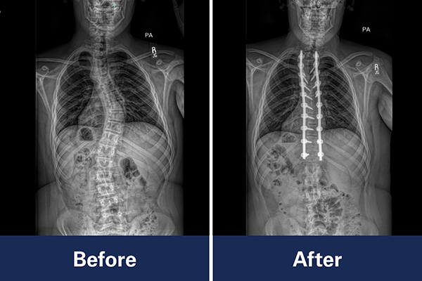 Bradley Gonzalez before and after X-ray