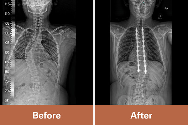 Brandon Gonzalez before and after X-ray